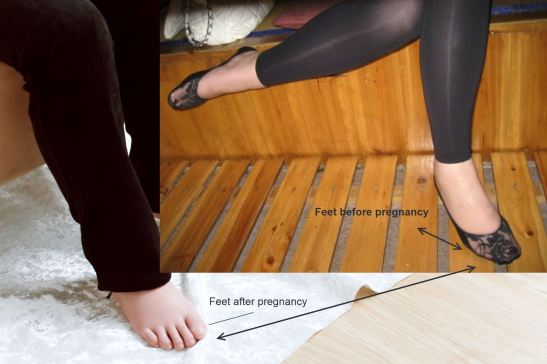 Vivian's feet - before and after pregnancy